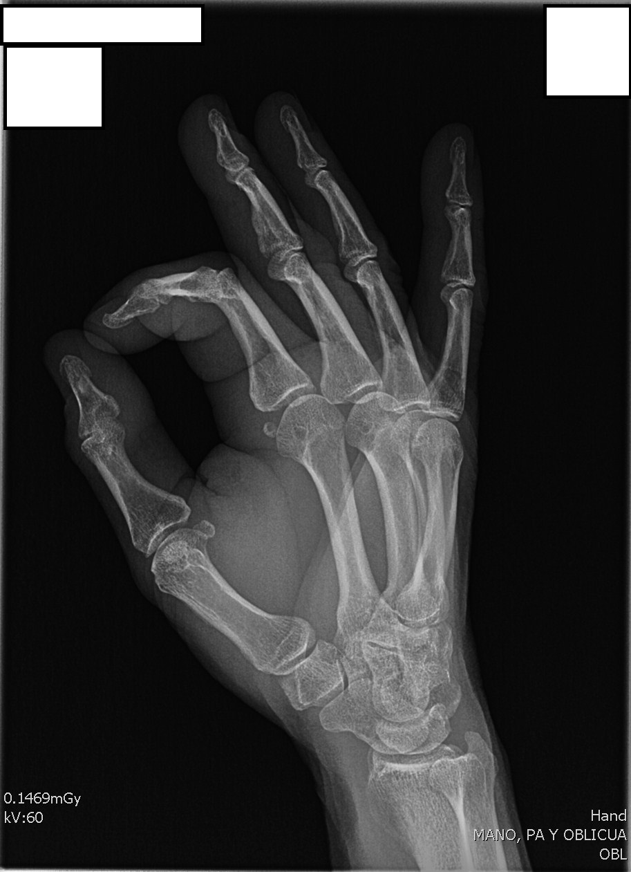 Proyección oblicua mano 2